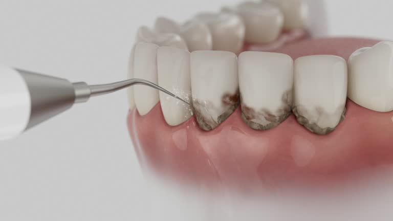 Reliable Emergency Dentist contractor in Bennington, NE by Smile Center Dentistry